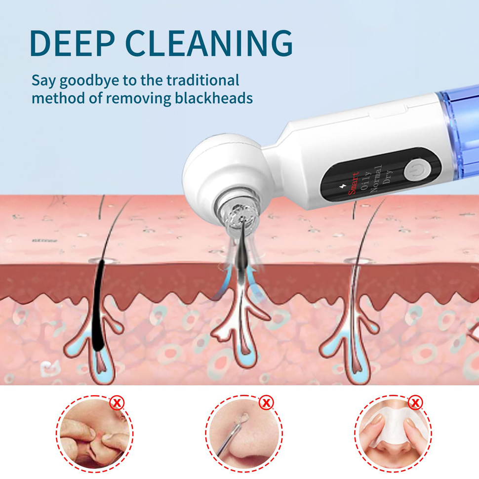 Blackhead Remover Pore Vacuum  - огляд і ціна Pore Vacuum