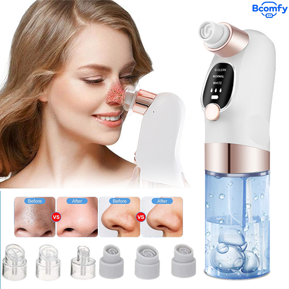 Electric Blackhead Remover Vac - огляд і ціна Pore Vacuum