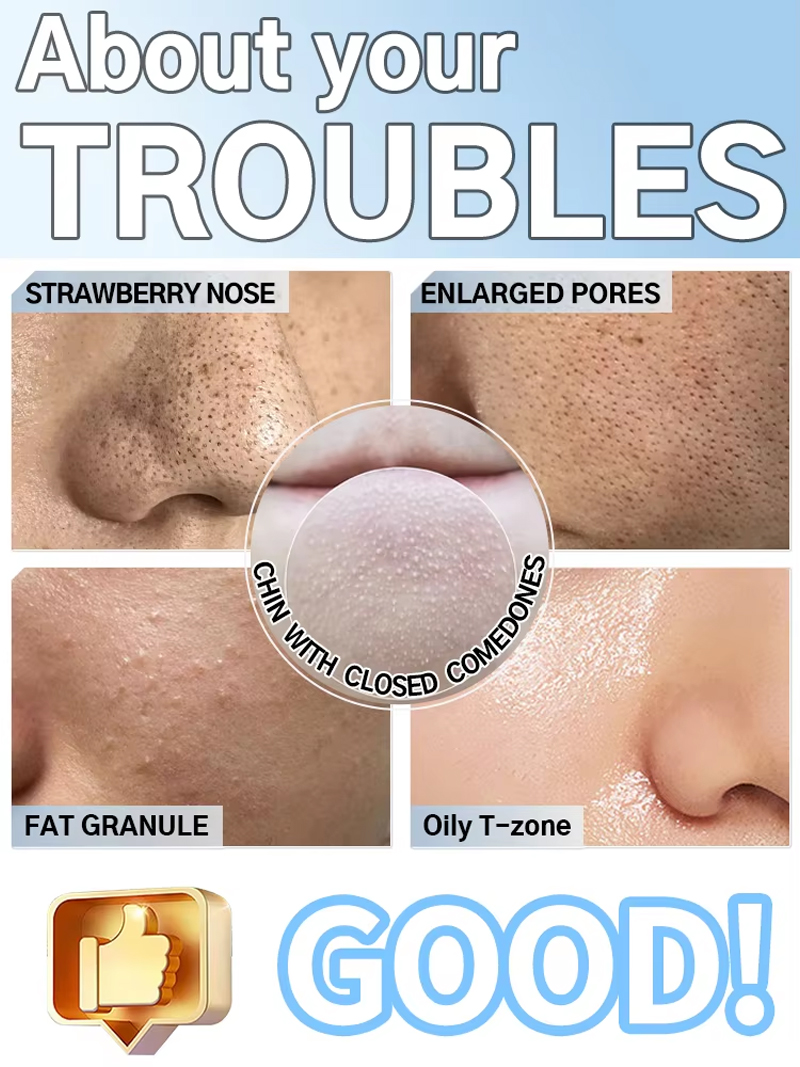 Electric Pore Vacuum Blackhead - огляд і ціна Pore Vacuum
