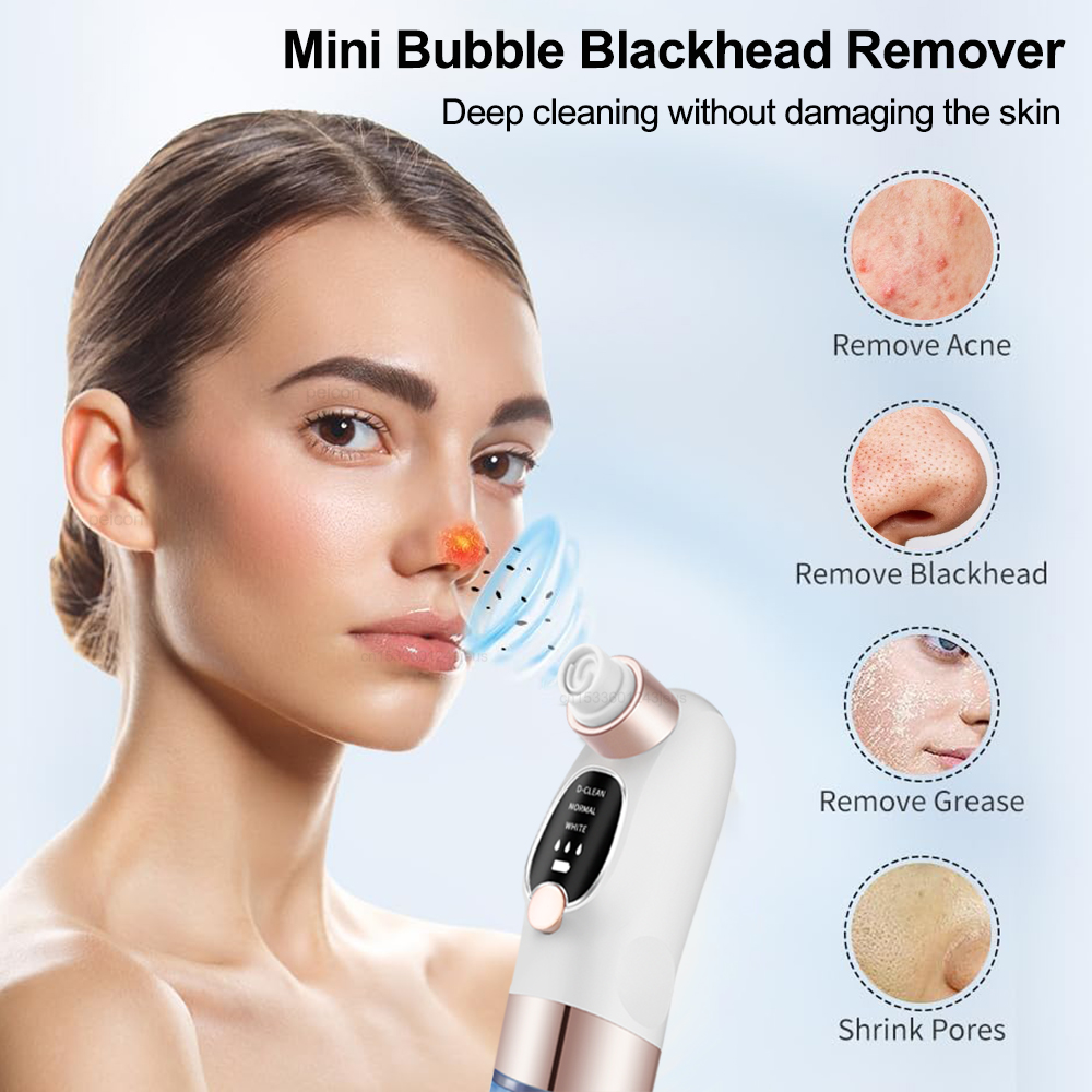 Blackhead Remover Electric Bla - огляд і ціна Pore Vacuum